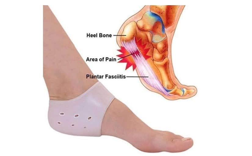 any cure for plantar fasciitis